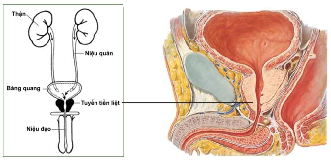 Cách chữa trị bệnh viêm tuyến tiền liệt mãn tính khỏi dứt điểm 1